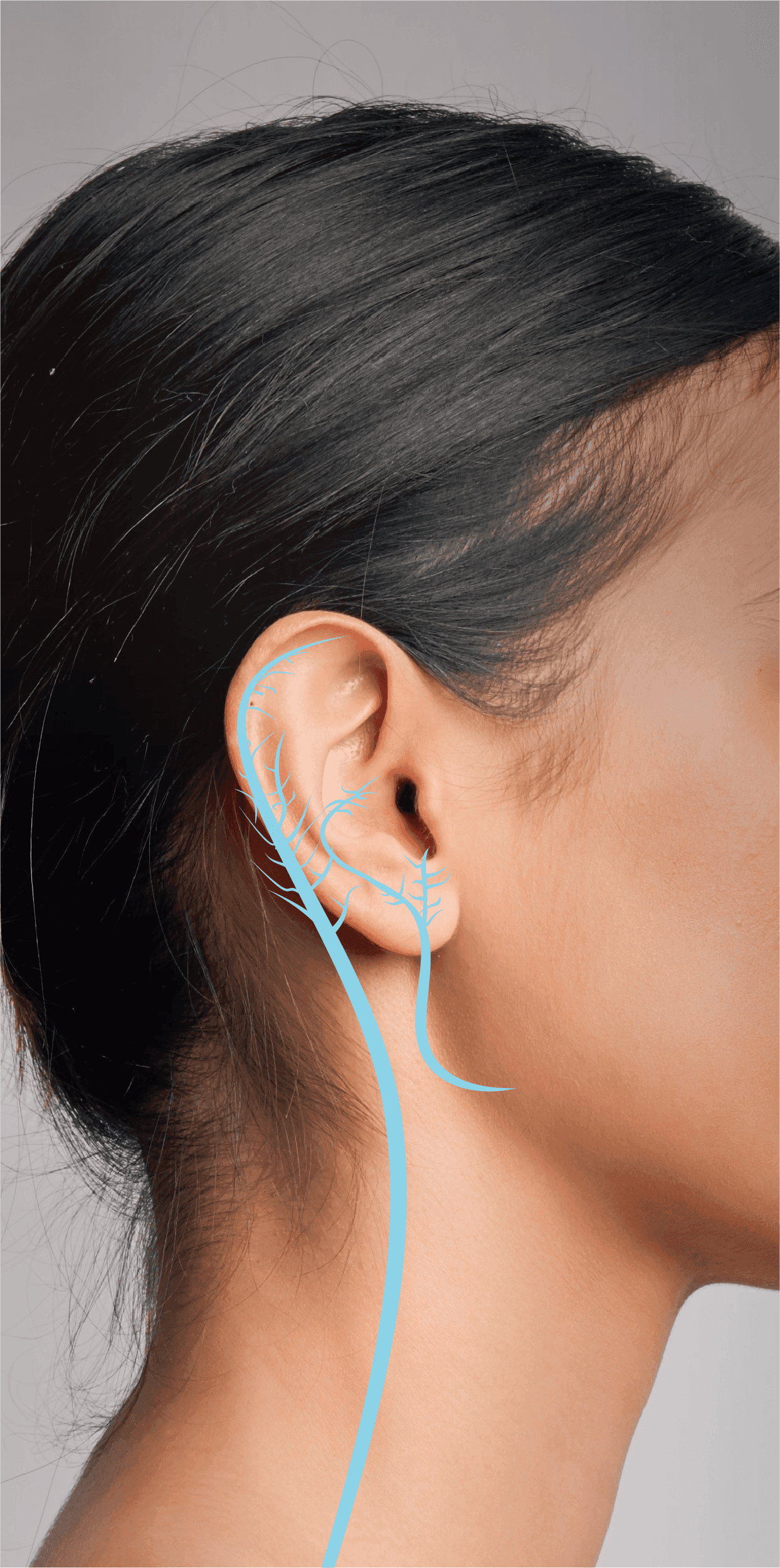 Illustration showing branches of the vagus nerve around the outer ear